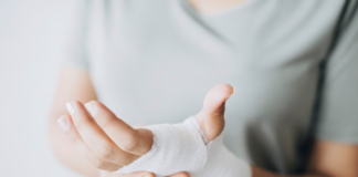 Campanha alerta sobre risco de queimaduras queimaduras