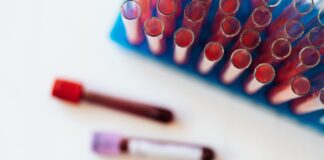 Processo utilizado para diagnóstico de câncer de sangue reduz gastos com leucemia infantil no Brasil Processo utilizado para diagnóstico de câncer de sangue reduz gastos com leucemia infantil no Brasil