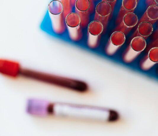 Processo utilizado para diagnóstico de câncer de sangue reduz gastos com leucemia infantil no Brasil
