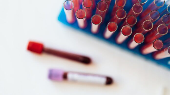 pexels-karolina-grabowska-4226902-1-scaled-2048x1152 Processo utilizado para diagnóstico de câncer de sangue reduz gastos com leucemia infantil no Brasil