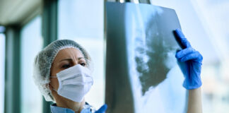 Riscos dos pneumococos para crianças e adultos vão além de pneumonias Pneumonias