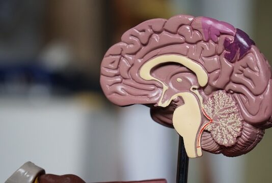Organização Mundial do AVC alerta que 90% dos derrames são preveníveis AVC