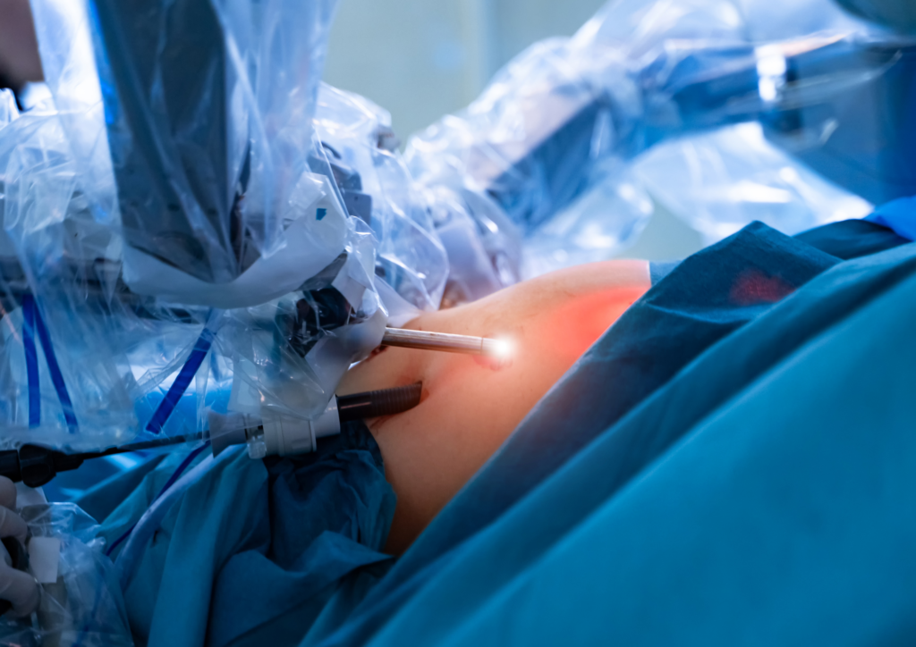 Robôs cirurgiões são capazes de realizar procedimentos complexos com precisão milimétrica