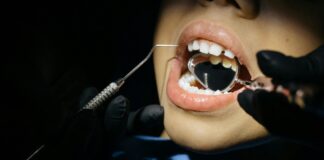 Adolescentes com cárie já apresentam sinais de colapso da saúde, aponta estudo Adolescentes com maus hábitos alimentares e que consomem álcool e tabaco têm maior risco de consequências negativas