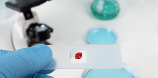 Brasil elimina transmissão vertical do HIV; entenda transmissão vertical HIV