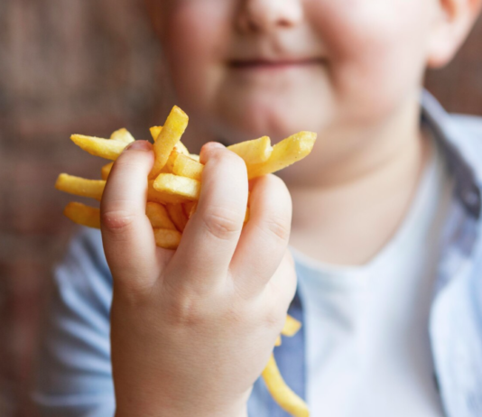 Obesidade em crianças: complicações, tratamento e como buscar ajuda obesidade em crianças