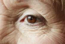 Glaucoma tem progressão silenciosa e pode levar à cegueira glaucoma