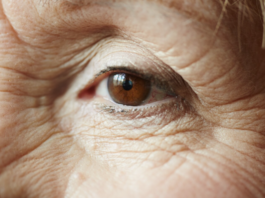 Glaucoma tem progressão silenciosa e pode levar à cegueira