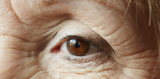 Glaucoma tem progressão silenciosa e pode levar à cegueira glaucoma