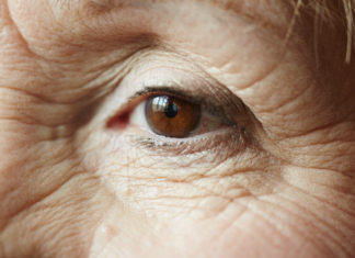 Glaucoma tem progressão silenciosa e pode levar à cegueira glaucoma