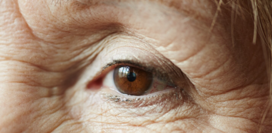 Glaucoma tem progressão silenciosa e pode levar à cegueira