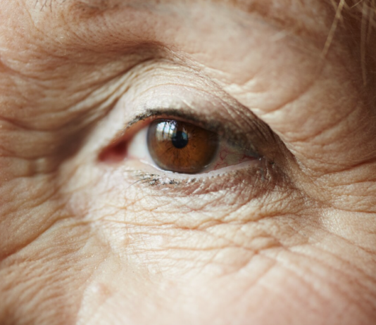 Glaucoma tem progressão silenciosa e pode levar à cegueira glaucoma