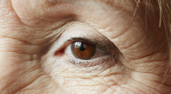 Glaucoma tem progressão silenciosa e pode levar à cegueira