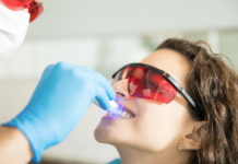 Clareamento dental pode ser feito por qualquer pessoa? clareamento dental