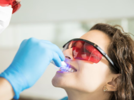 Clareamento dental pode ser feito por qualquer pessoa?