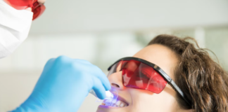 Clareamento dental pode ser feito por qualquer pessoa? clareamento dental