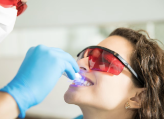 Clareamento dental pode ser feito por qualquer pessoa? clareamento dental