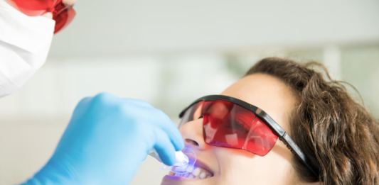 Clareamento dental pode ser feito por qualquer pessoa?