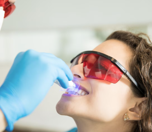 Clareamento dental pode ser feito por qualquer pessoa?