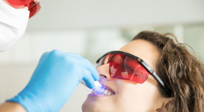 Clareamento dental pode ser feito por qualquer pessoa?
