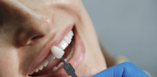 Conheça as diferenças entre facetas e lentes de contato bucais facetas e lentes de contato
