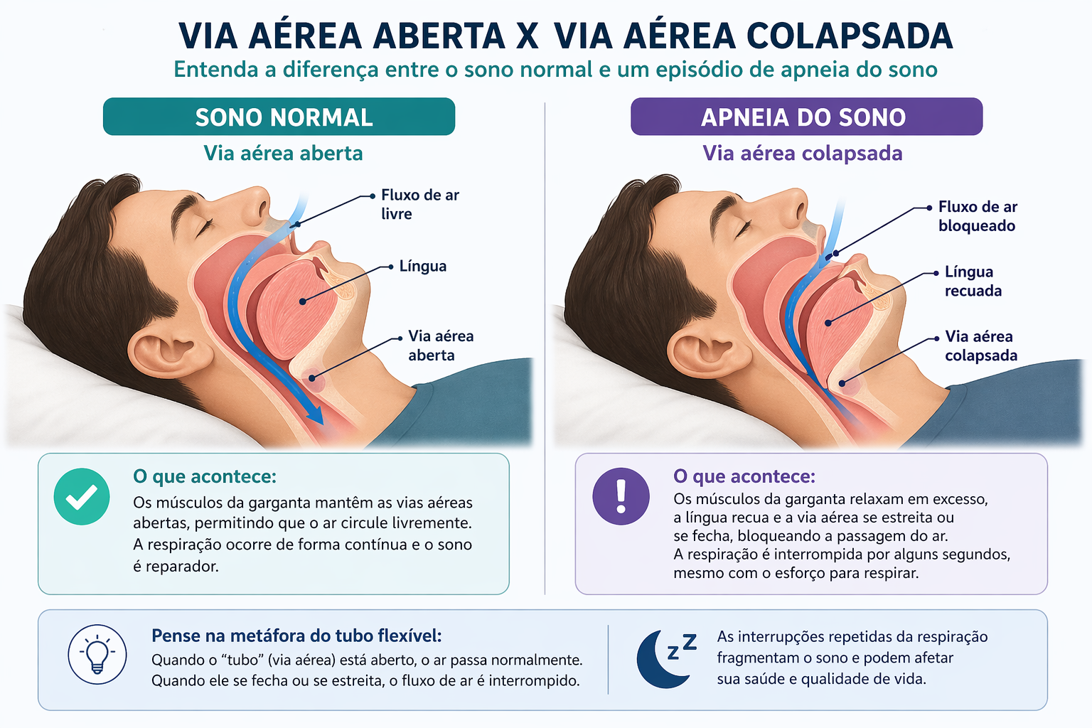 apneia do sono