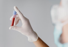 Exame de sangue: tempo de validade, indicação, rotina e mais exame de sangue
