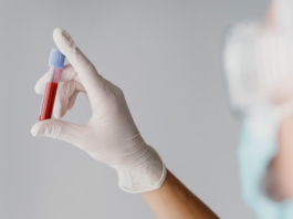 Exame de sangue: tempo de validade, indicação, rotina e mais