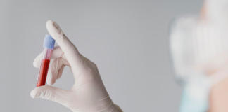 Exame de sangue: tempo de validade, indicação, rotina e mais exame de sangue
