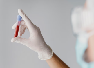 Exame de sangue: tempo de validade, indicação, rotina e mais exame de sangue