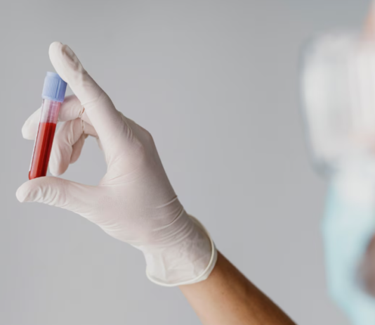 Exame de sangue: tempo de validade, indicação, rotina e mais