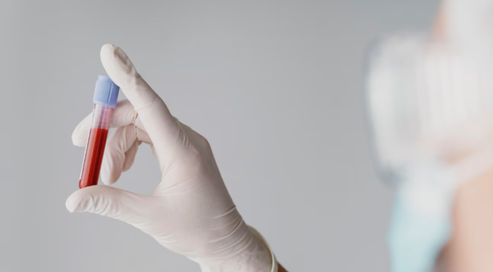 Exame de sangue: tempo de validade, indicação, rotina e mais