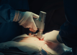 Primeira cirurgia cardíaca extracorpórea de peito aberto é realizada no Hospital Unimed Londrina cirurgia cardíaca extracorpórea de peito aberto