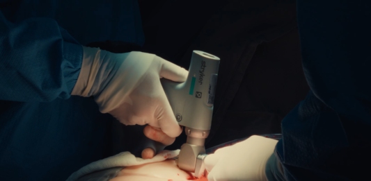 Primeira cirurgia cardíaca extracorpórea de peito aberto é realizada no Hospital Unimed Londrina