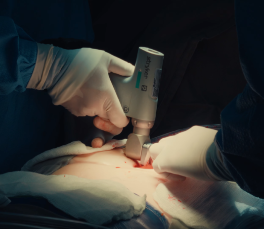 Primeira cirurgia cardíaca extracorpórea de peito aberto é realizada no Hospital Unimed Londrina
